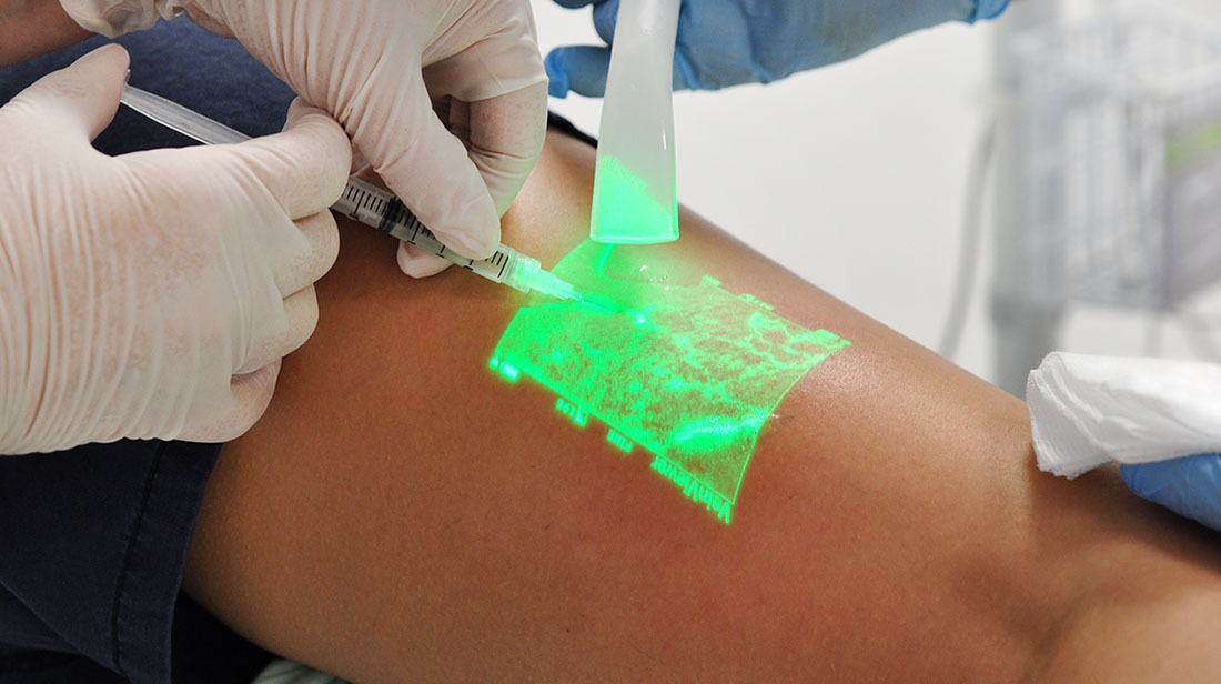 farewell-varicose-veins-embracing-clacs-treatment-chronic-venous-insufficiency